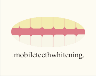 Mobile Teeth Whitening